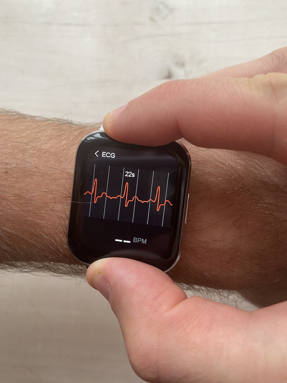 What Does An Abnormal Ecg Test Mean